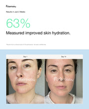 Filterbaby Skincare Faucet Filter 2.0